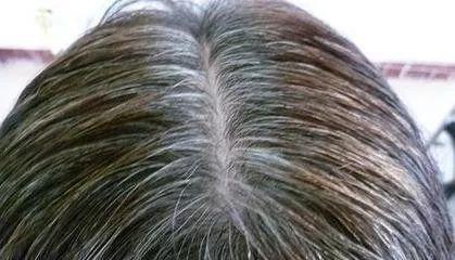 女子每月染发一次十年后得肝硬化,你还敢染头发吗?