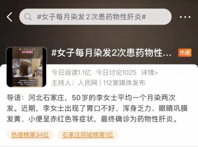 ​注意！女子每月染发 2 次患药物性肝炎