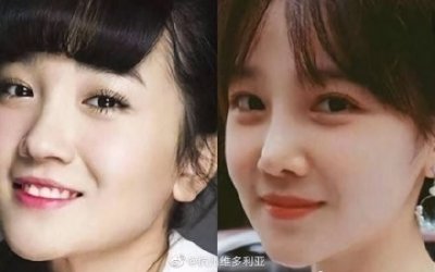 陈小纭公开承认曾“整容”十几次,旧照曝光后,网友:差距太大了