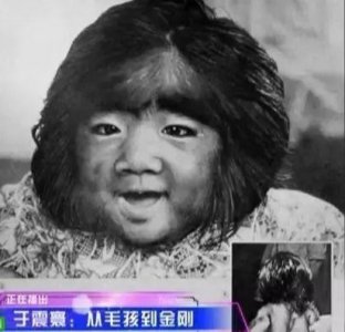 ​中国毛孩：8岁演电影爆红，成年绝望到自杀，恋情受阻仍不放弃