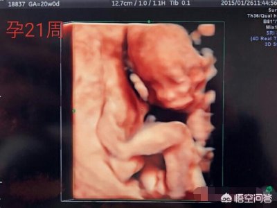 怀孕21周的胎儿图是什么样的(21周B超)