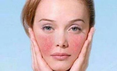 ​敏感肌肤的特点及护理方法是什么