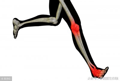 ​慢性骨髓炎 5个治疗手段，还得一步一步来