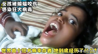 ​世界首个狂犬病发作，却意外存活下来的人，她到底经历了什么？