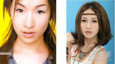 ​萧亚轩整容前后，萧亚轩和黄皓为什(黄皓真的喜欢萧亚轩吗)